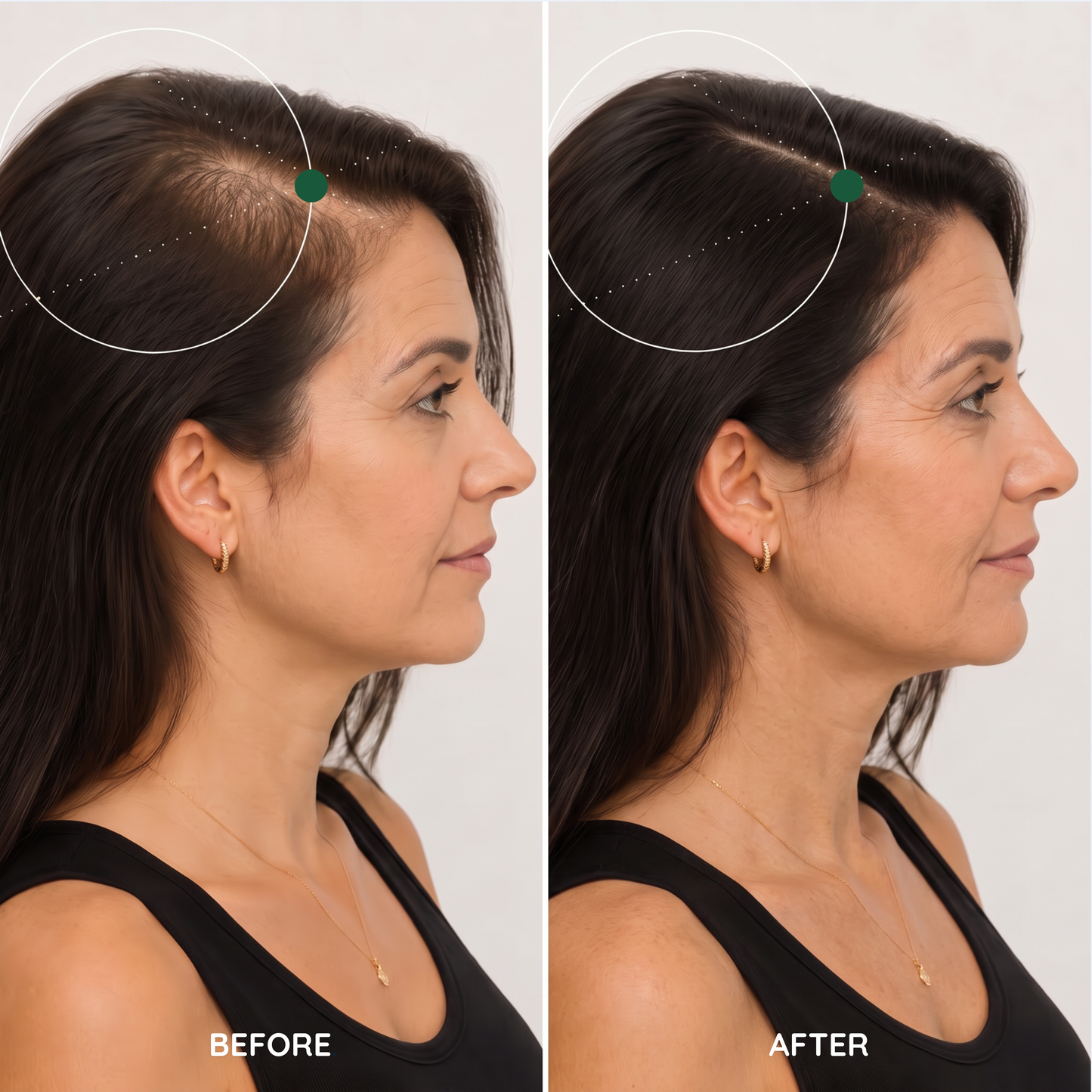 Erase Years of Aging at Home in Just 2 Weeks
