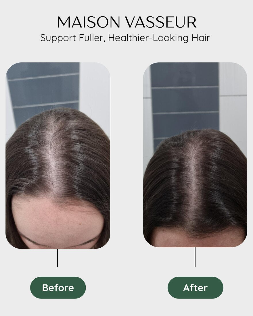 Before and after hair part comparison