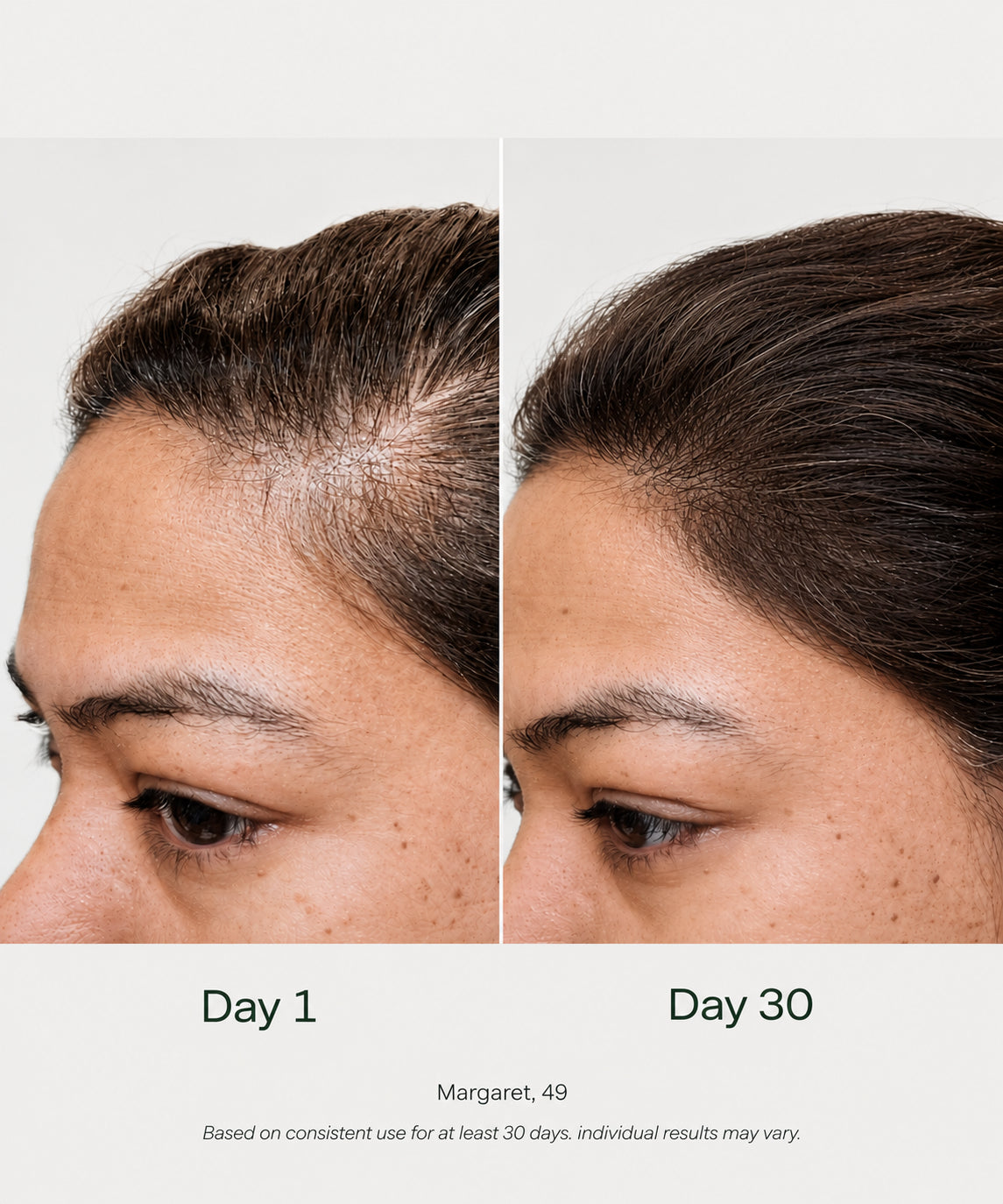 Applying Maison Vasseur Growth Hair to the scalp